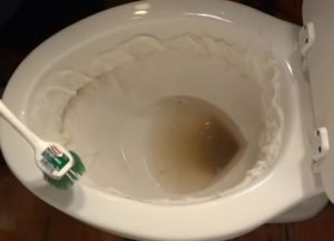 How to Remove Hard Water Stains from a Toilet?