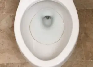 How to get rid of toilet ring 