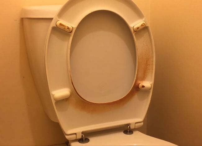 Causes of Yellow Stains On A Toilet Seat