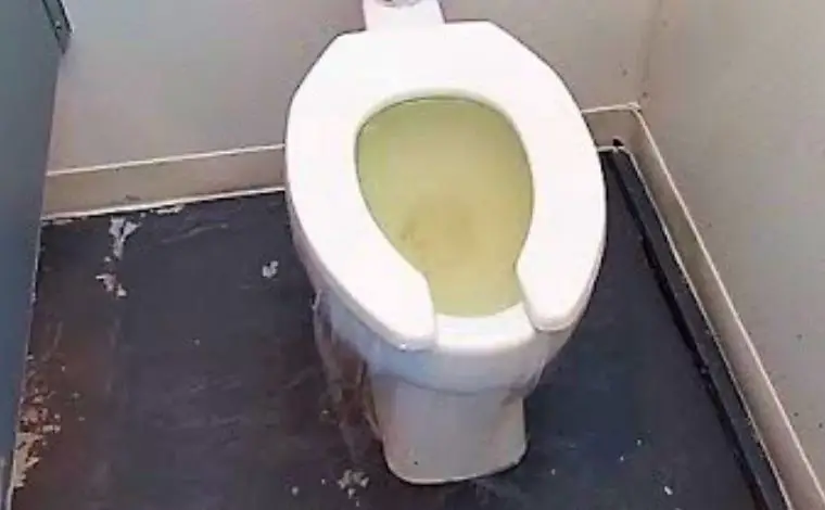  toilet overflowing with poop