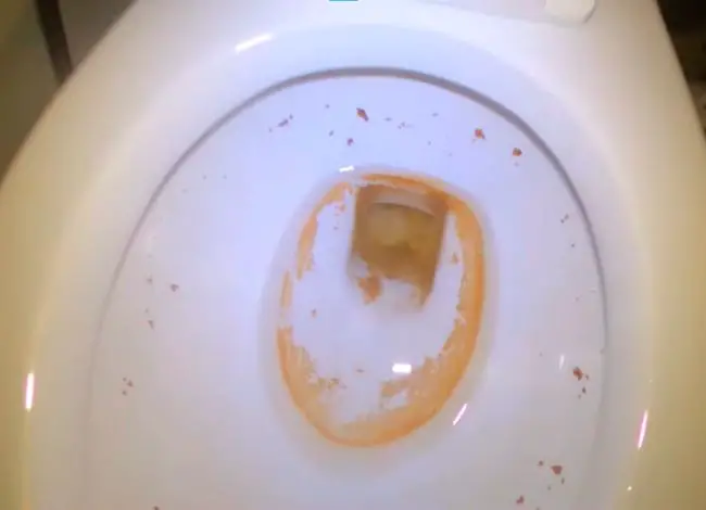 toilet bacteria